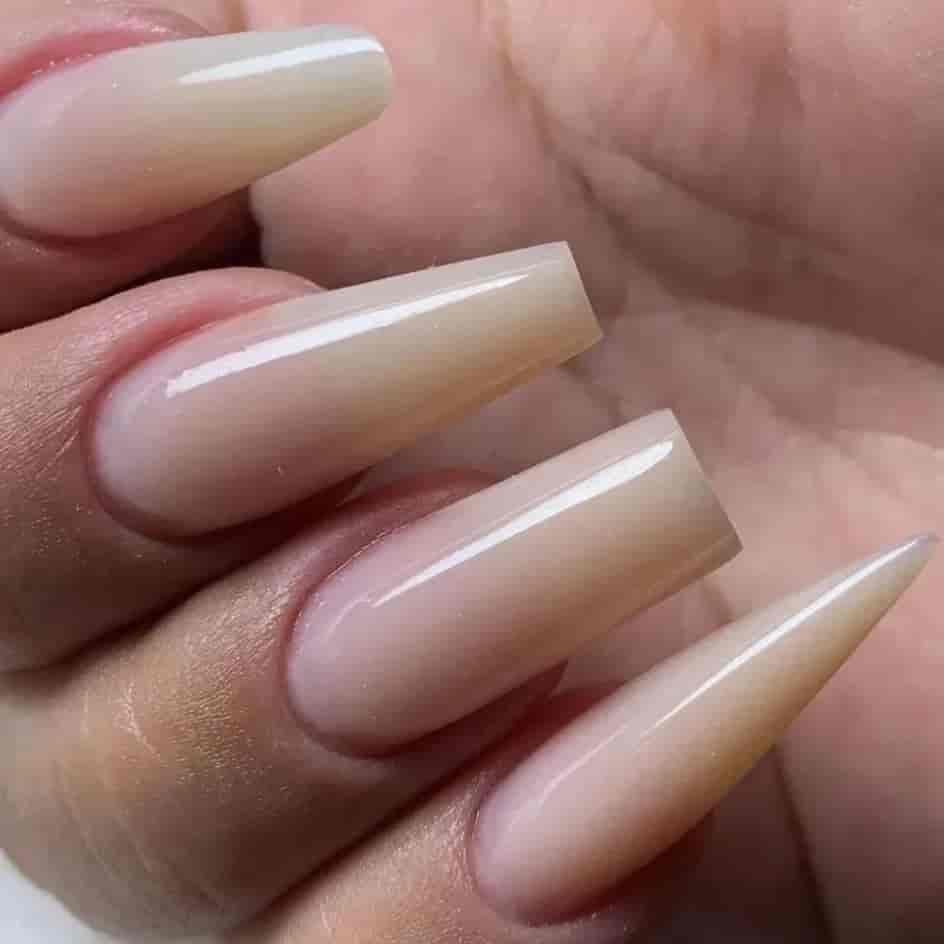کاشت ژل